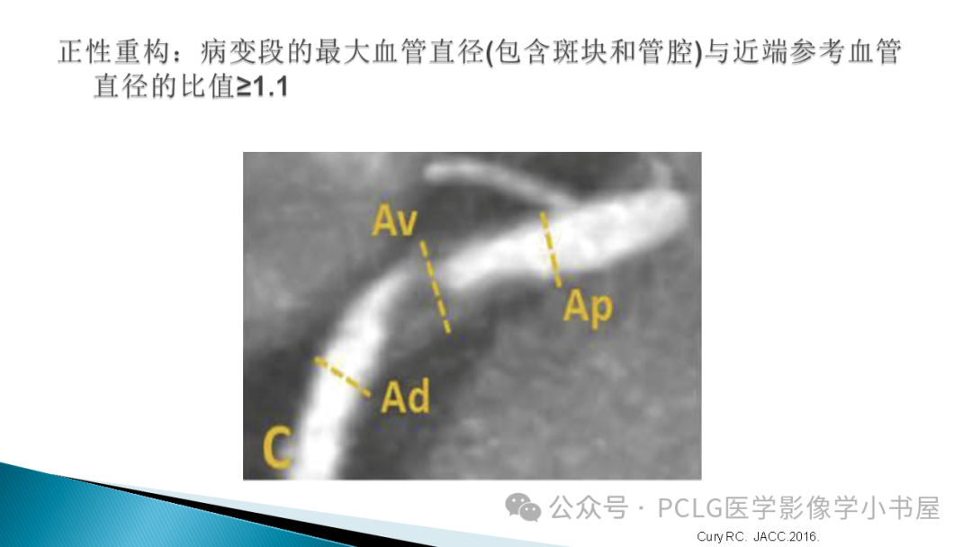 影像PPT - 【PPT】冠状动脉CTA检查方法及影像诊断-29