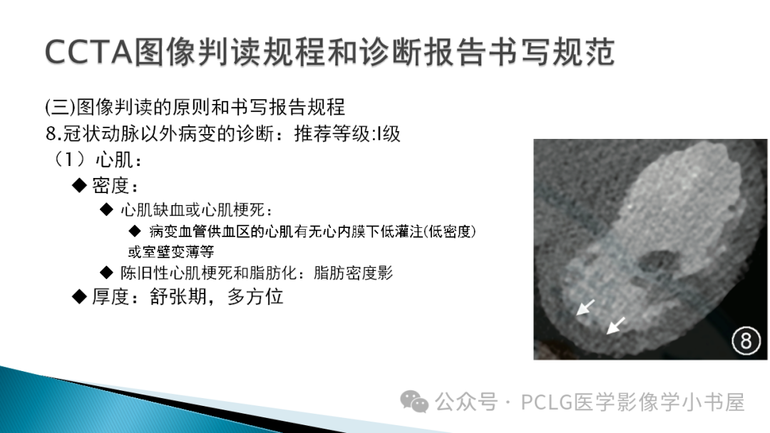 影像PPT - 【PPT】冠状动脉CTA检查方法及影像诊断-42